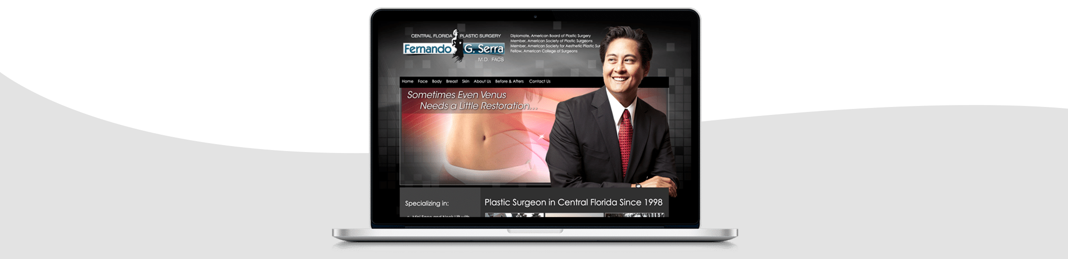 SEO Case Study | Central Florida Plastic Surgery