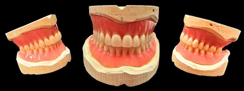 Complete Standard Denture